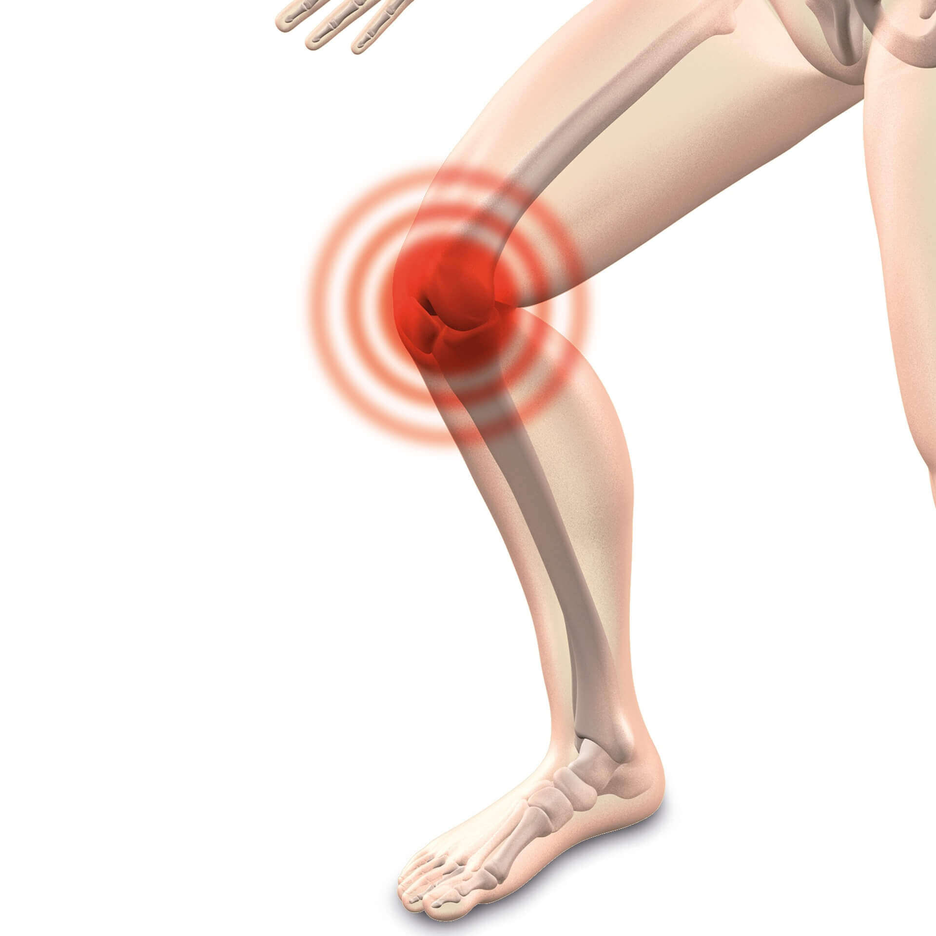 Fußreflexzonenmassage bei Arthrose im Knie mit Full Balance Fußreflexzonenmassage bei Arthrose im Knie mit Full Balance